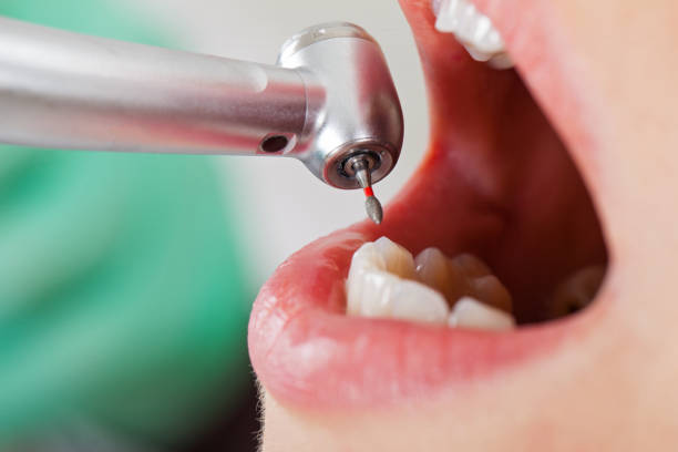 Best Emergency Dental Care for Broken or Chipped Teeth in Juno Ridge, FL